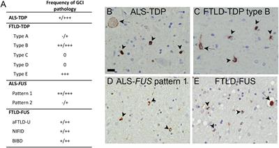 Contribution of RNA/DNA Binding Protein Dysfunction in Oligodendrocytes in the Pathogenesis of the Amyotrophic Lateral Sclerosis/Frontotemporal Lobar Degeneration Spectrum Diseases